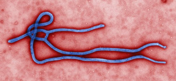 A colorized transmission electron micrograph (TEM) image of an Ebola virus virion, created by CDC microbiologist Cynthia Goldsmith. Credit: CDC global Flickr stream.