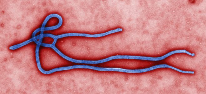 A colorized transmission electron micrograph (TEM) image of an Ebola virus virion, created by CDC microbiologist Cynthia Goldsmith. Credit: CDC global Flickr stream.